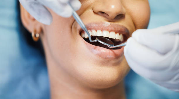 Best Dental Abscess Treatment in James City, NC