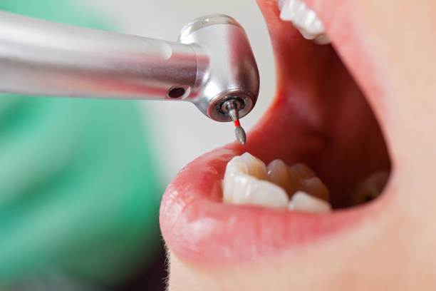 Best Urgent Dental Care for Toothaches in James City, NC